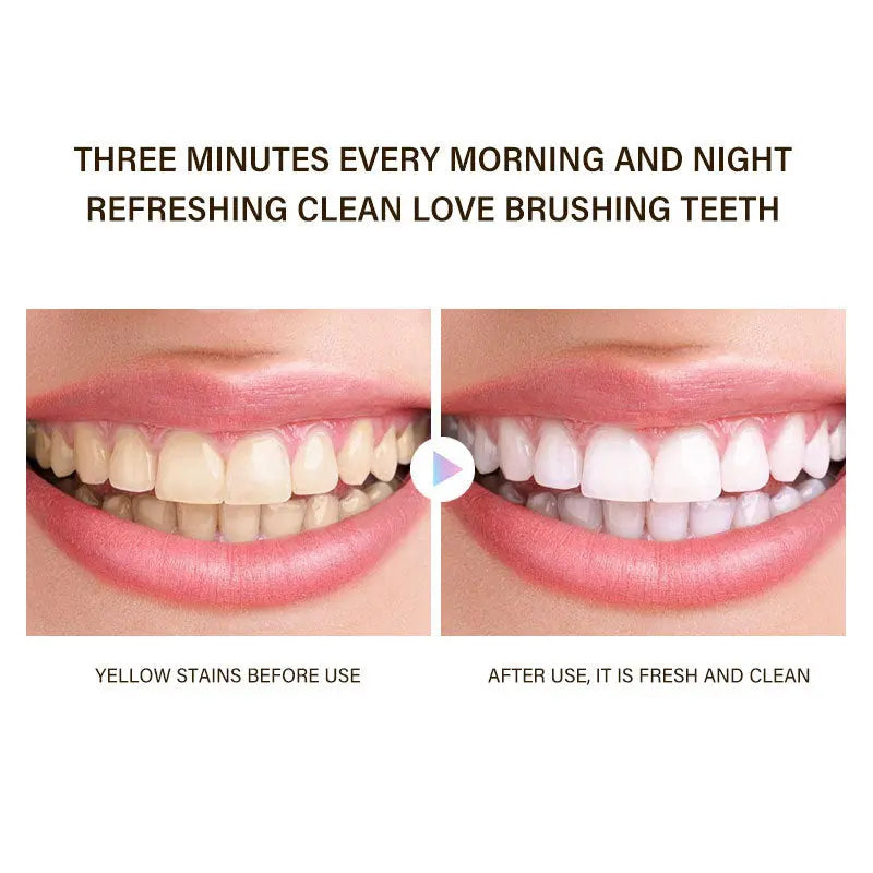 Niacinamide Whitening Dual-color Toothpaste with Mint Flavor Dropsure